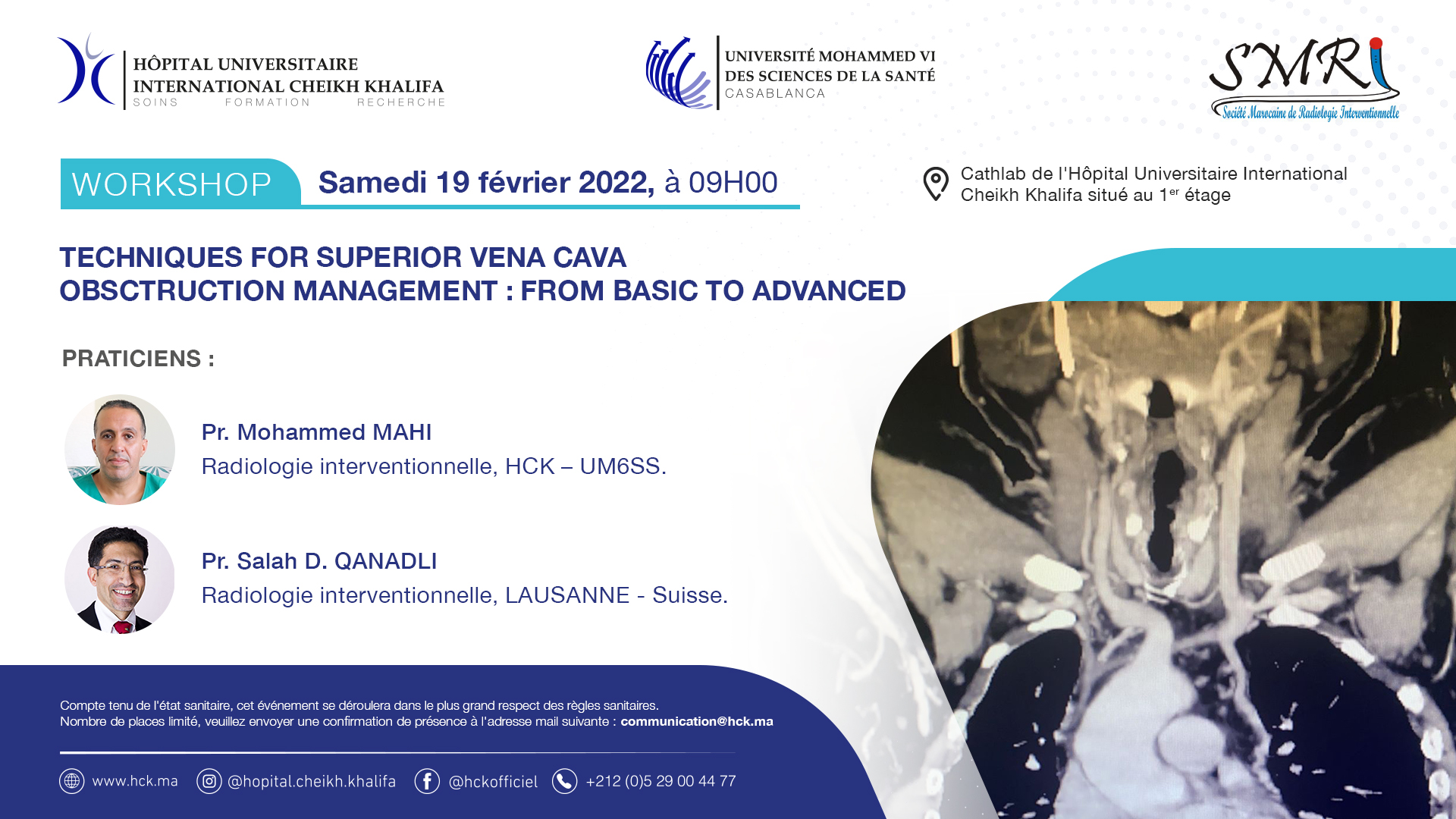WORKSHOP : TECHNIQUES FOR SUPERIOR VENA CAVA OBSTRUCTION MANAGEMENT : FROM BASIC TO ADVANCED 