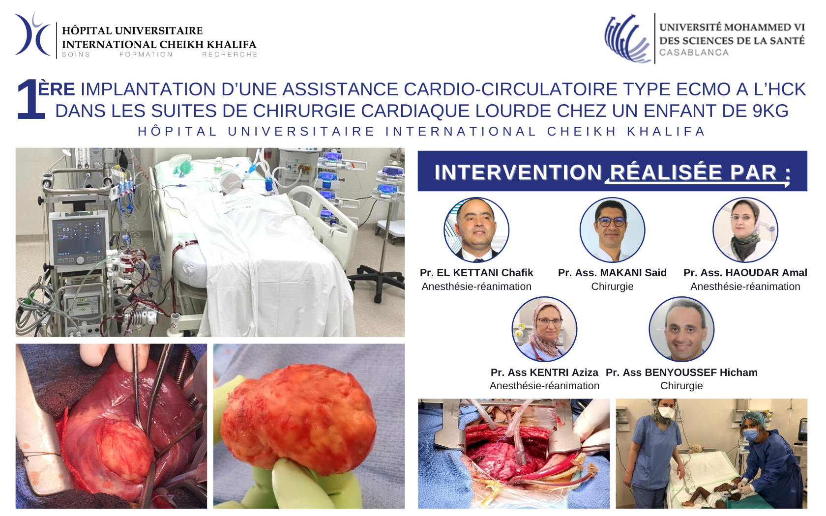 1ERE IMPLANTATION D’UNE ASSISTANCE CARDIO-CIRCULATOIRE TYPE ECMO A L’HCK DANS LES SUITES DE CHIRURGIE CARDIAQUE LOURDE CHEZ UN ENFANT DE 9KG 1ERE IMPLANTATION D’UNE ASSISTANCE CARDIO-CIRCULATOIRE TYPE ECMO A L’HCK DANS LES SUITES DE CHIRURGIE CARDIAQUE LOURDE CHEZ UN ENFANT DE 9KG