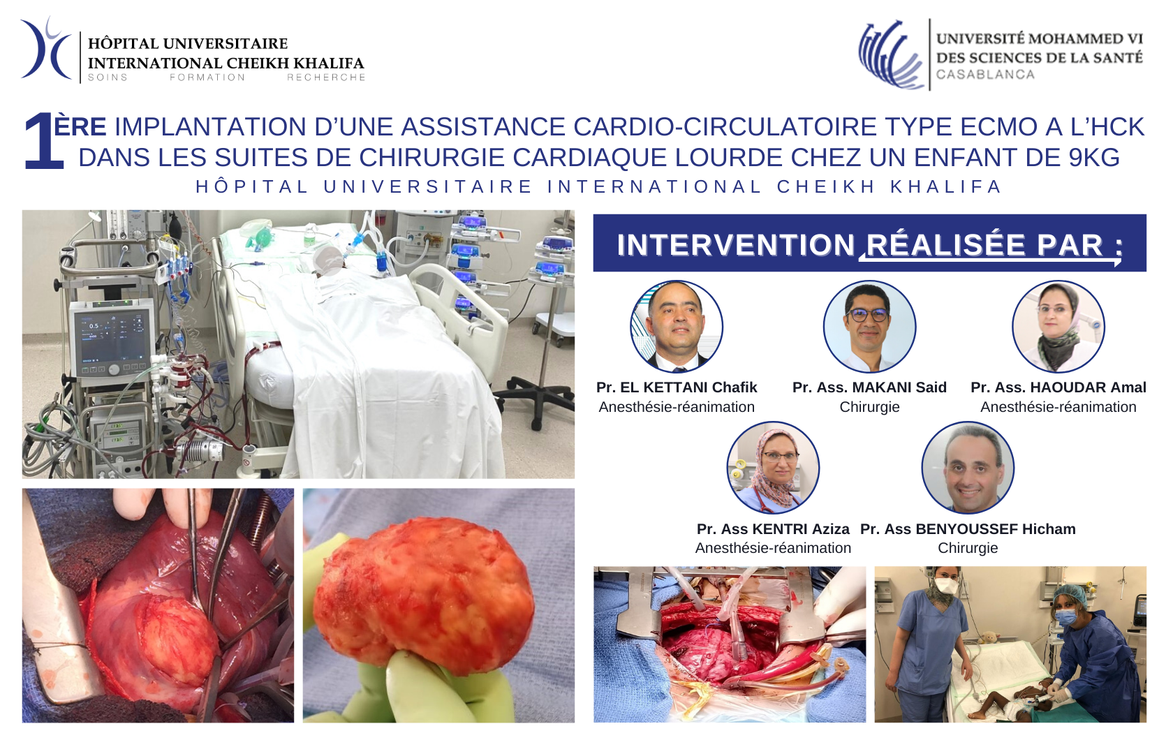 1ERE IMPLANTATION D’UNE ASSISTANCE CARDIO-CIRCULATOIRE TYPE ECMO A L’HCK DANS LES SUITES DE CHIRURGIE CARDIAQUE LOURDE CHEZ UN ENFANT DE 9KG