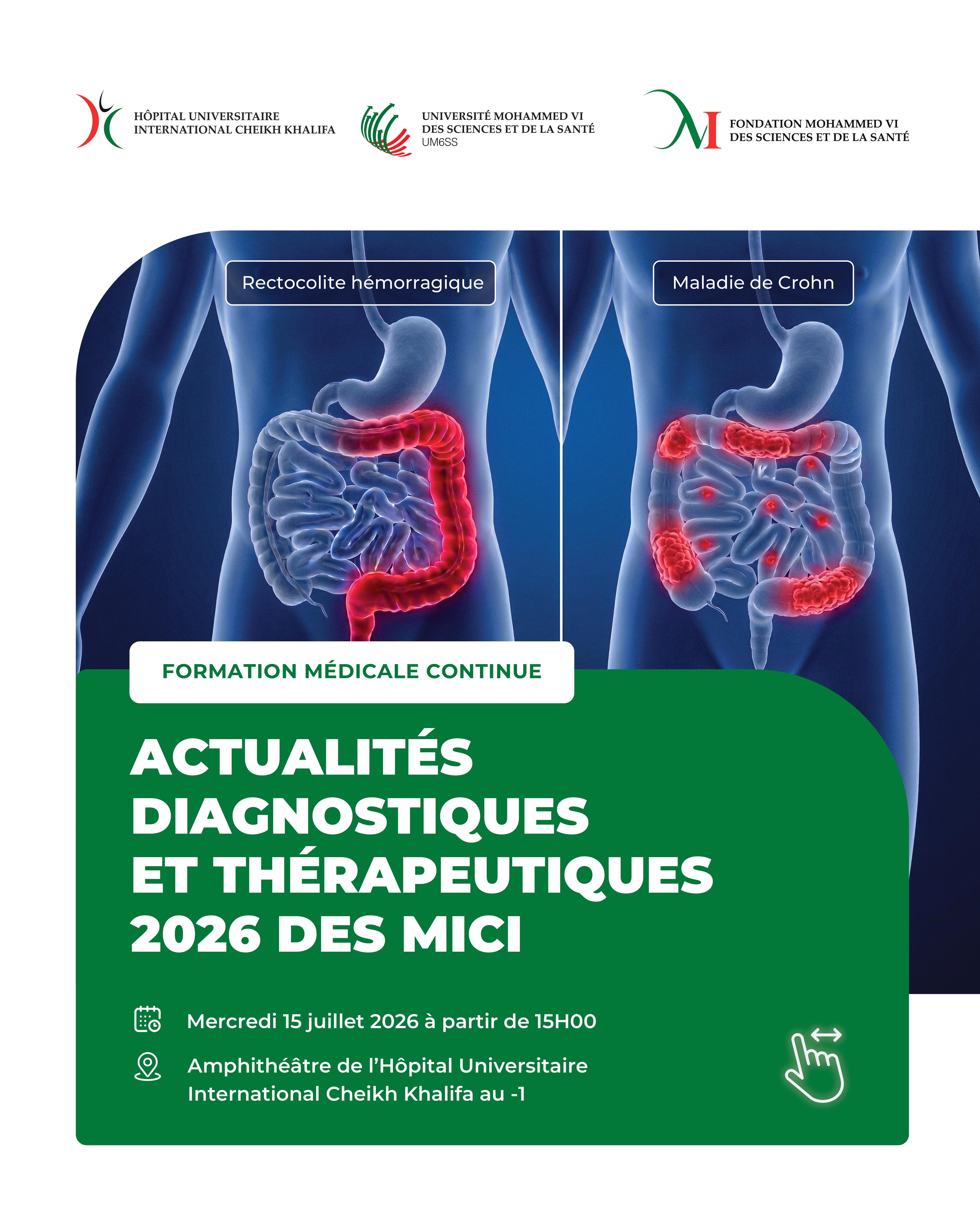 FORMATION MÉDICALE CONTINUE - ACTUALITÉS DIAGNOSTIQUES ET THÉRAPEUTIQUES 2026 DES MICI