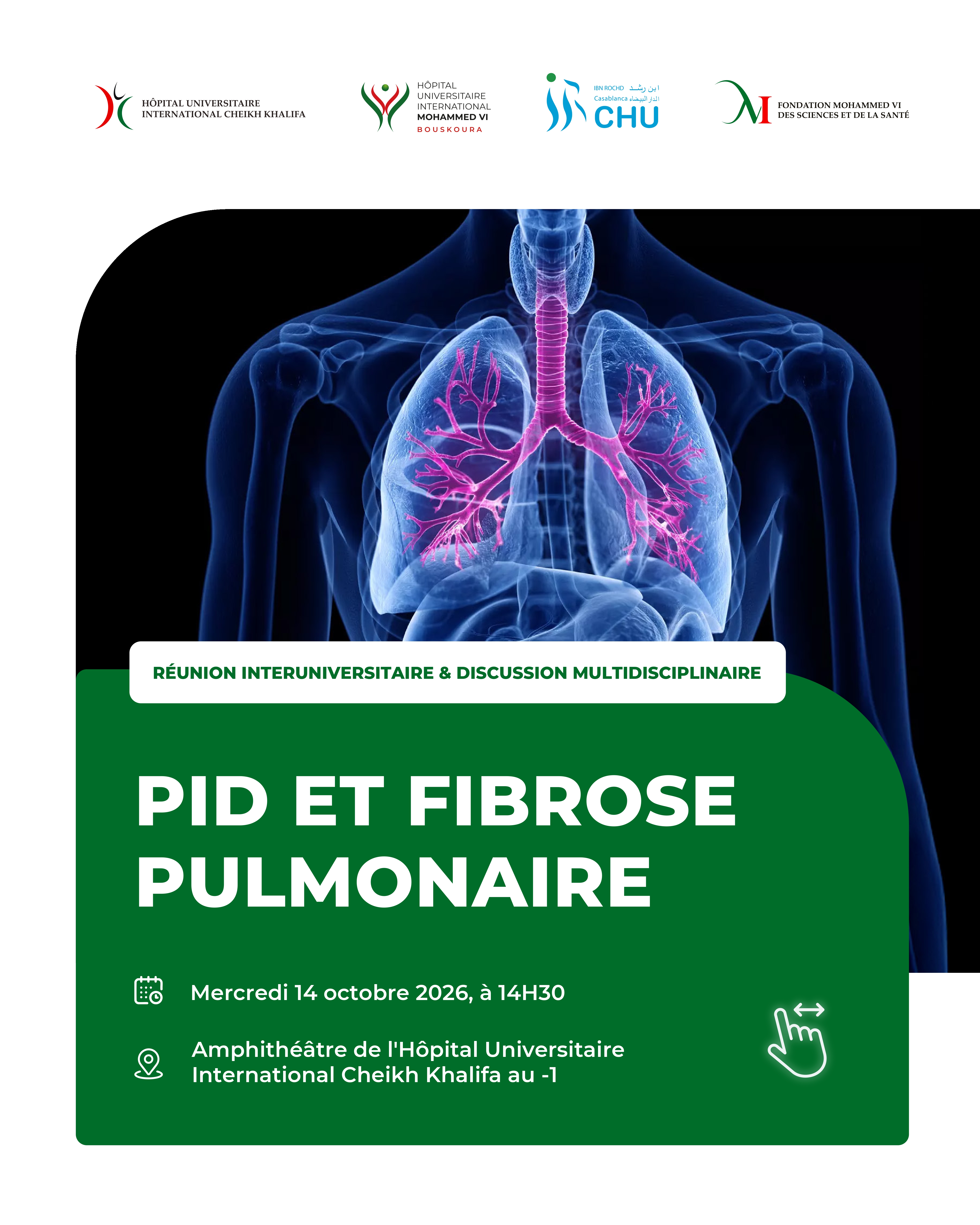 RÉUNION MULTIDISCIPLINAIRE  - PID ET FIBROSE PULMONAIRE