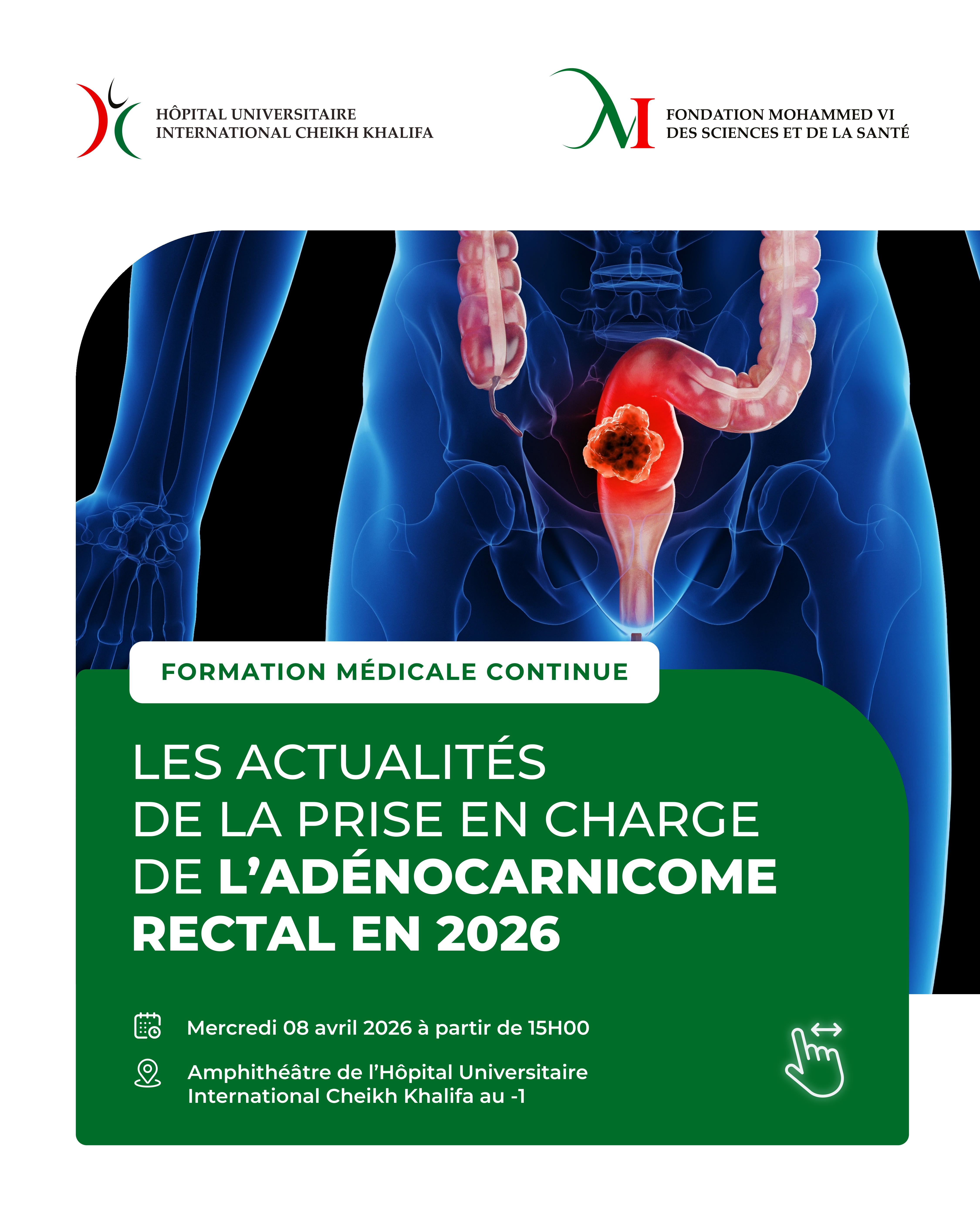 FORMATION MÉDICALE CONTINUE : LES ACTUALITÉS DE LA PRISE EN CHARGE DE L'ADÉNOCARCINOME RECTAL EN 2026 