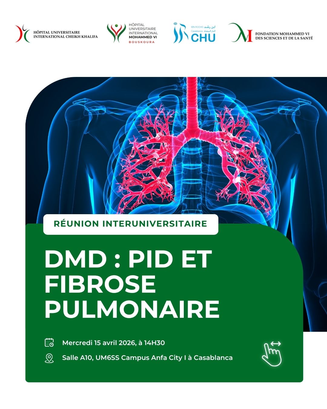 RÉUNION INTERUNIVERSITAIRE - DMD : PID ET FIBROSE PULMONAIRE
