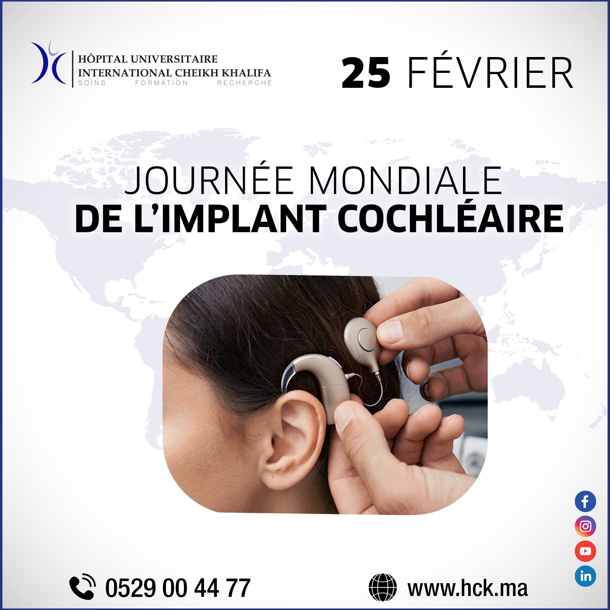 25 FÉVRIER : JOURNÉE MONDIALE DE L'IMPLANT COCHLÉAIRE