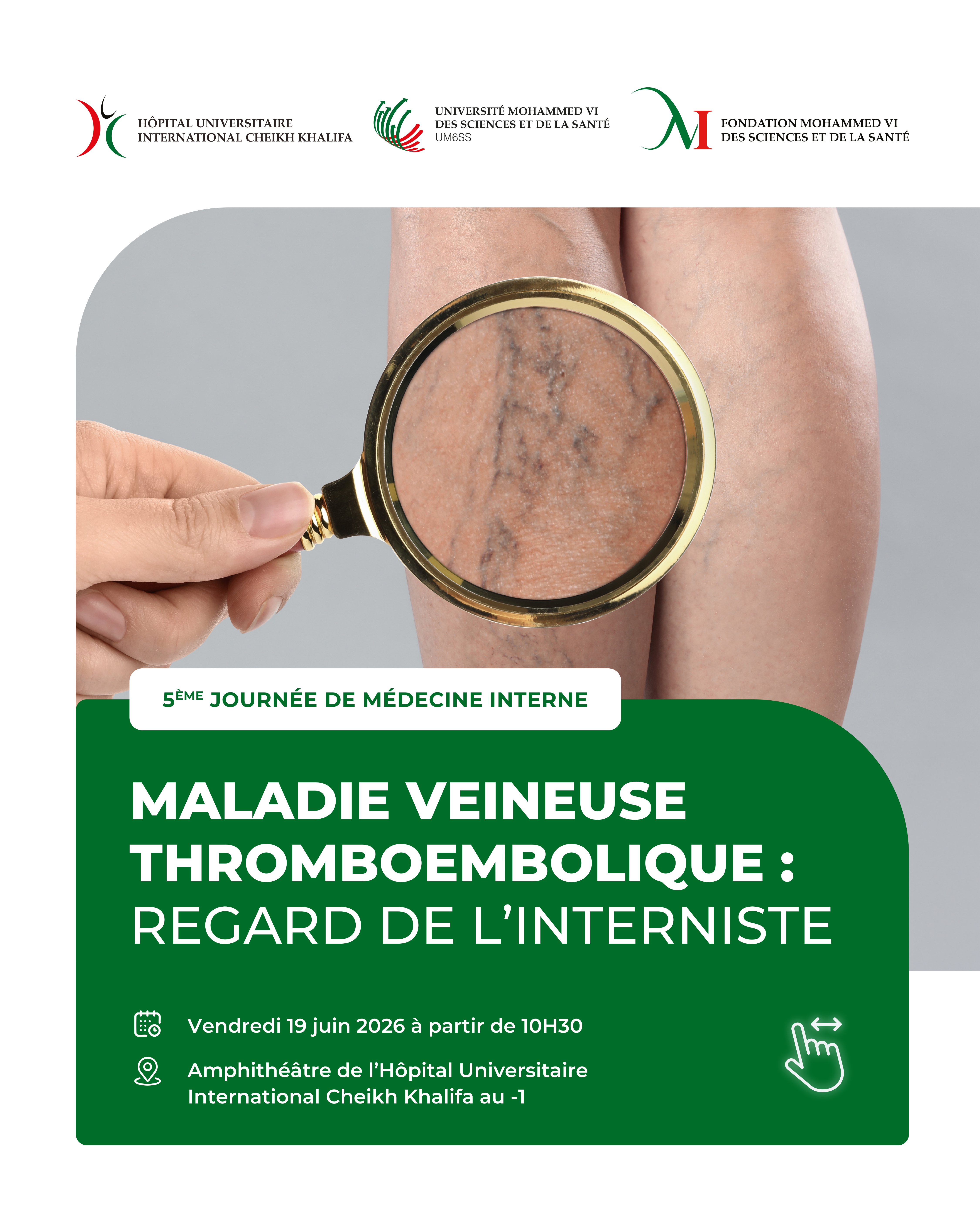 5ÈME JOURNÉE DE MÉDECINE INTERNE - MALADIE VEINEUSE THROMBOEMBOLIQUE : REGARD DE L'INTERNISTE