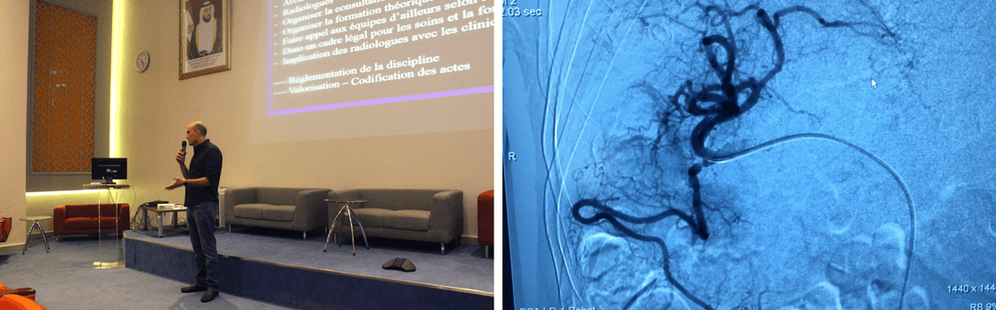 LA RADIOLOGIE INTERVENTIONNELLE À L’HÔPITAL CHEIKH KHALIFA