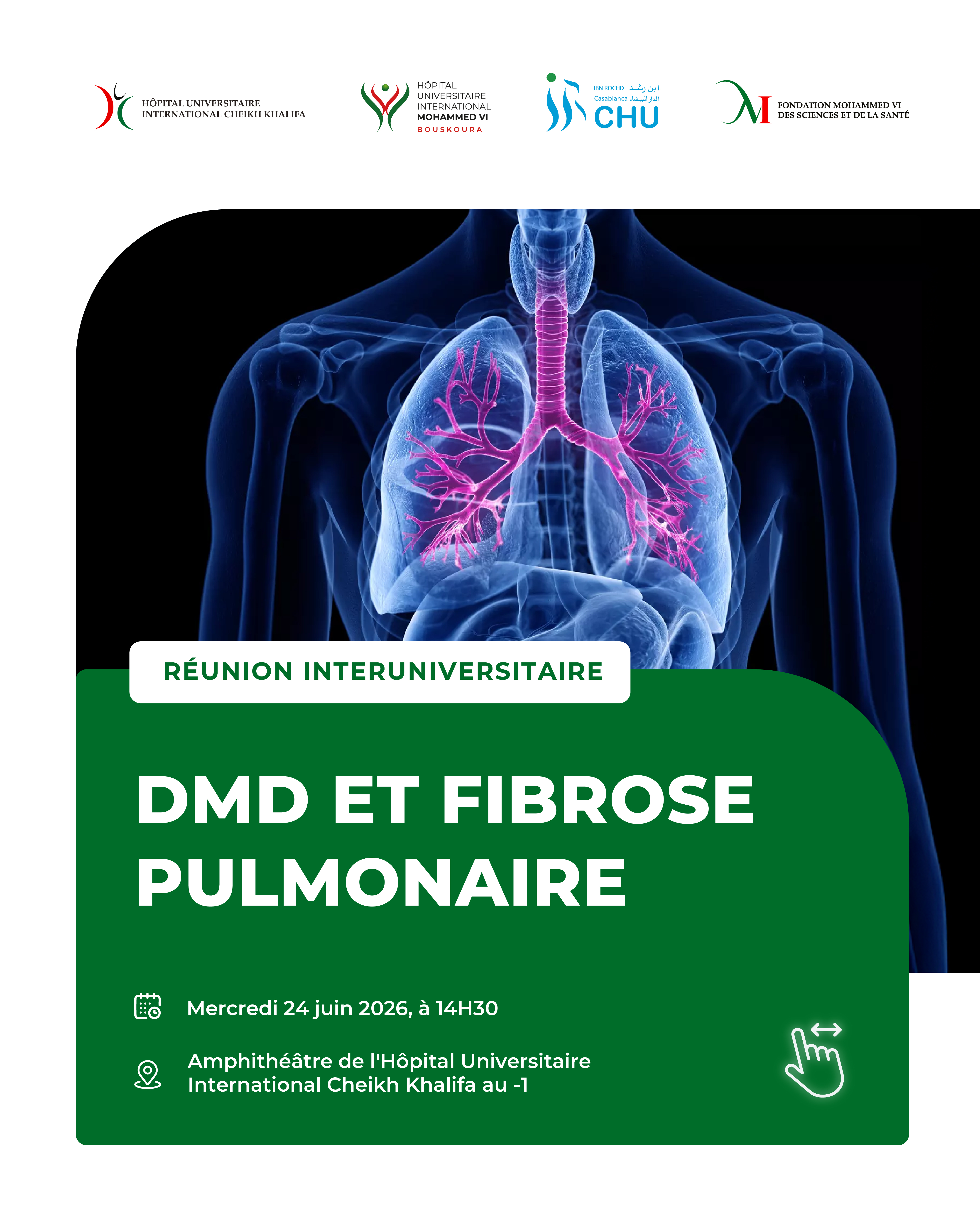 RÉUNION INTERUNIVERSITAIRE : DMD ET FIBROSE PULMONAIRE