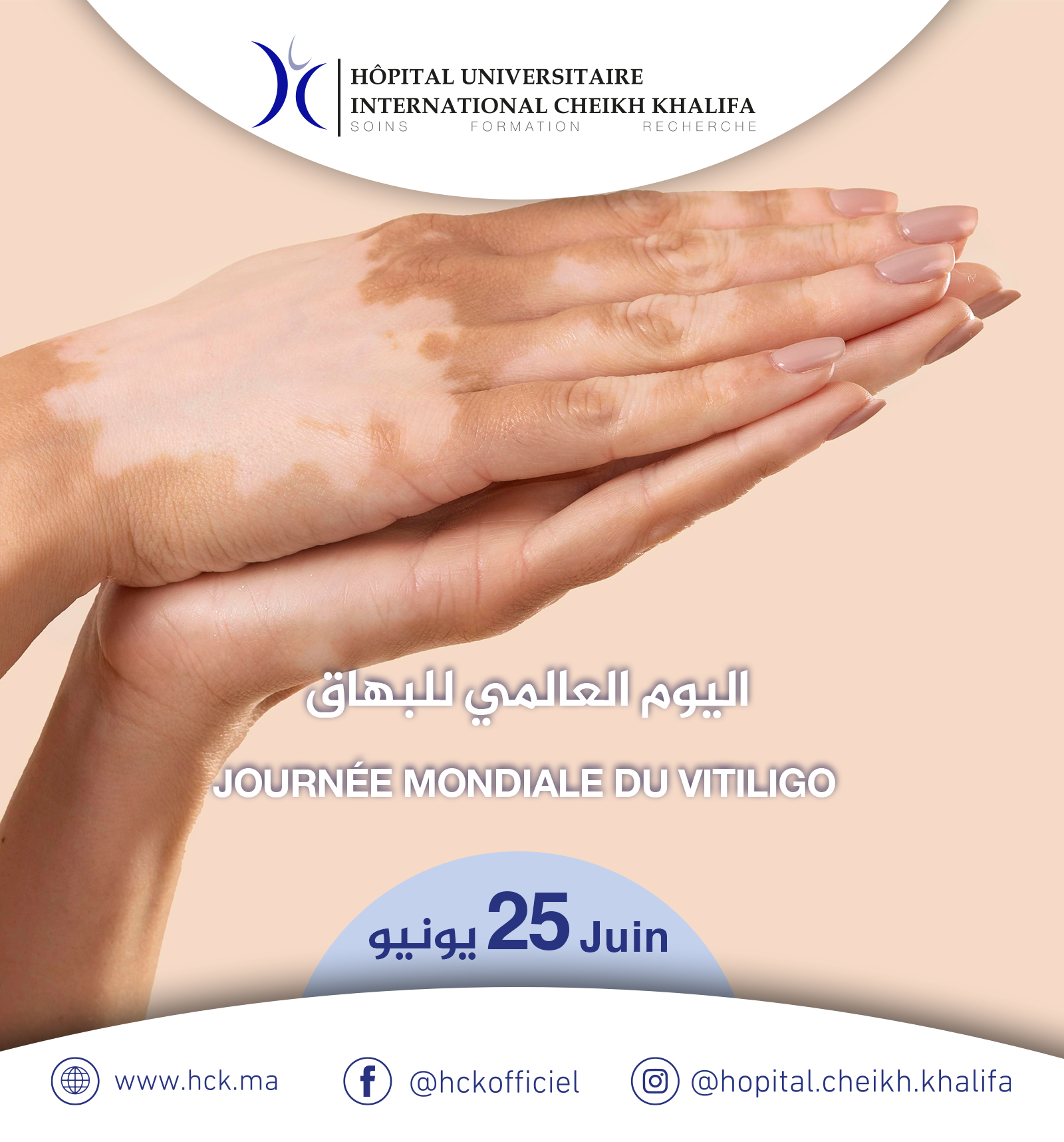 JOURNÉE MONDIALE DU VITILIGO JOURNÉE MONDIALE DU VITILIGO
