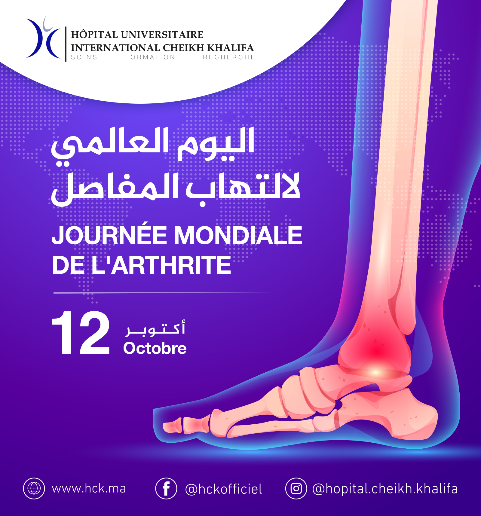 JOURNEE MONDIALE DE L'ARTHRITE JOURNEE MONDIALE DE L'ARTHRITE