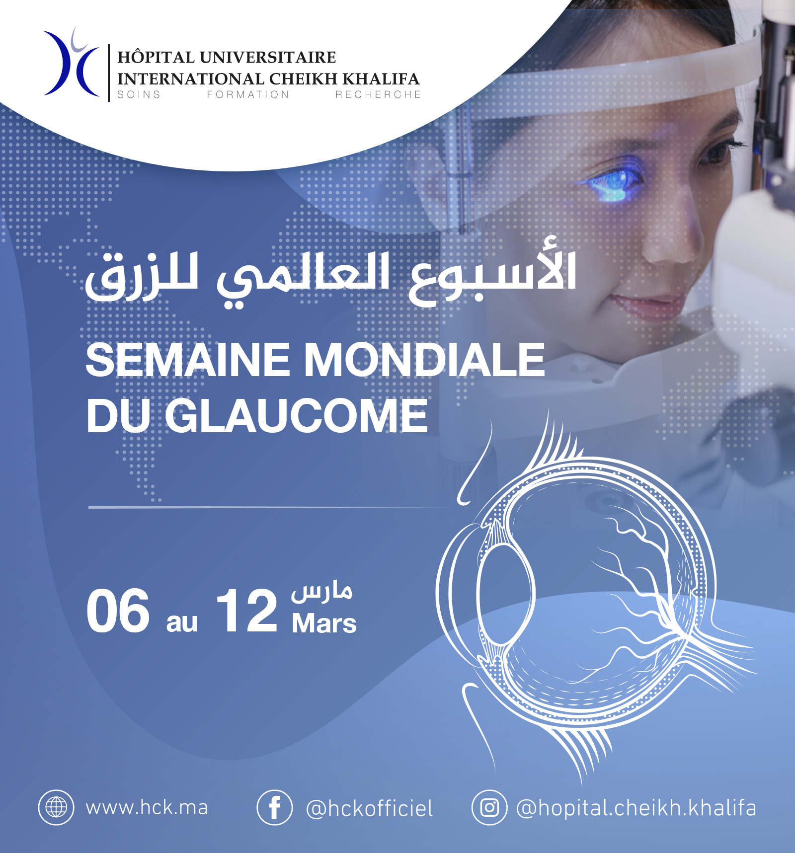 SEMAINE MONDIALE DU GLAUCOME