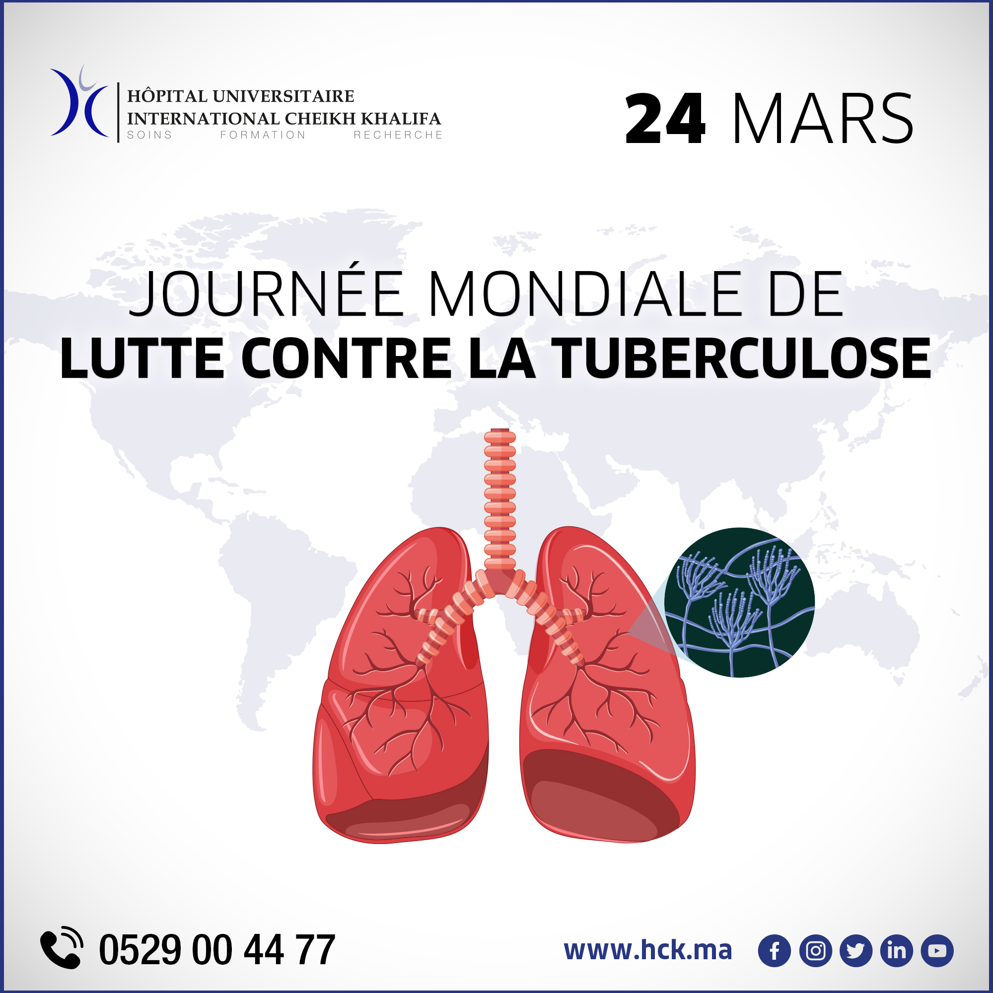 24 MARS : JOURNÉE MONDIALE DE LA TUBERCULOSE