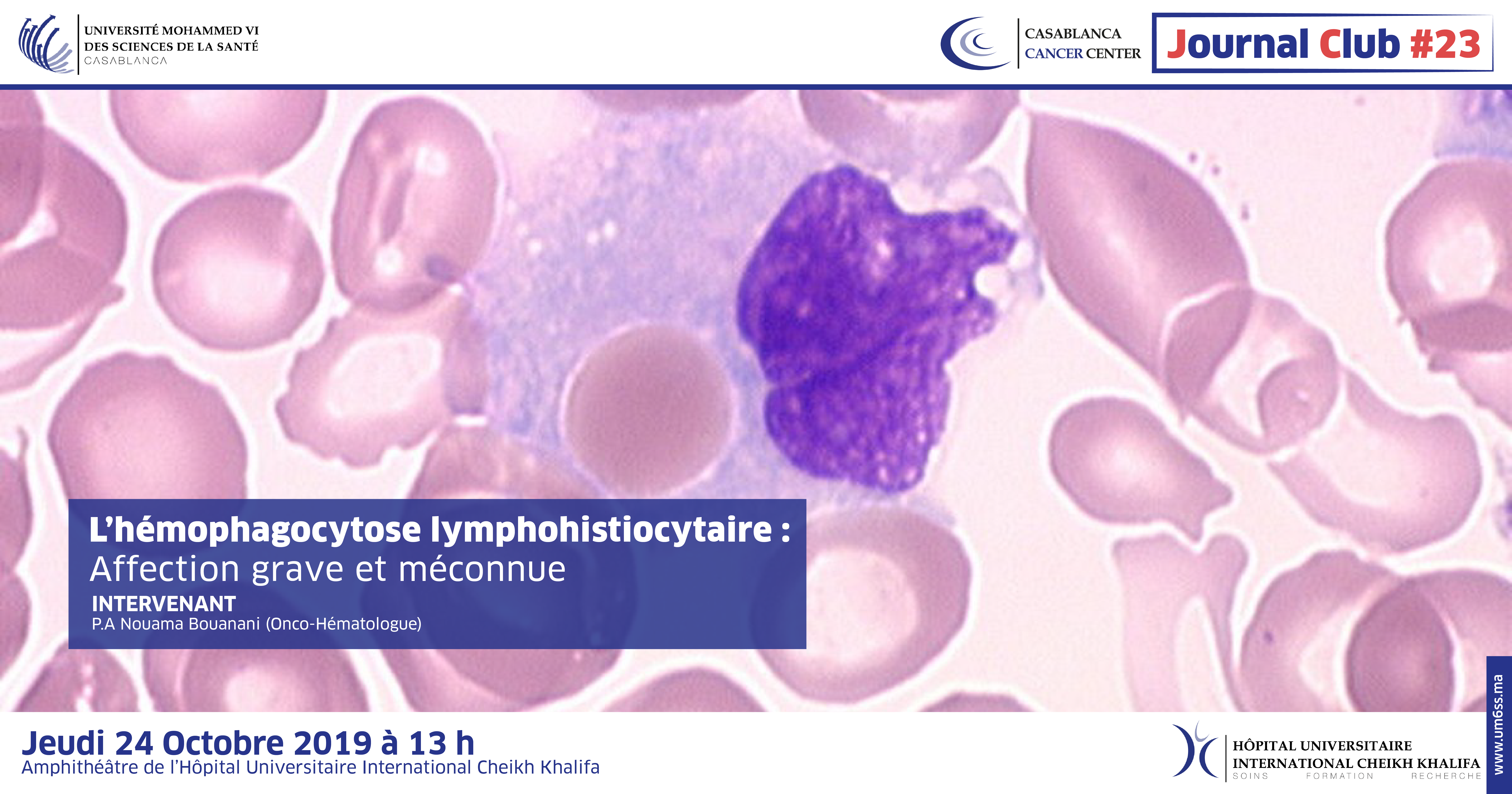 CCC JOURNAL CLUB #23 : L’HEMOPHAGOCYTOSE LYMPHOHISTIOCYTAIRE : AFFECTION GRAVE ET MECONNUE