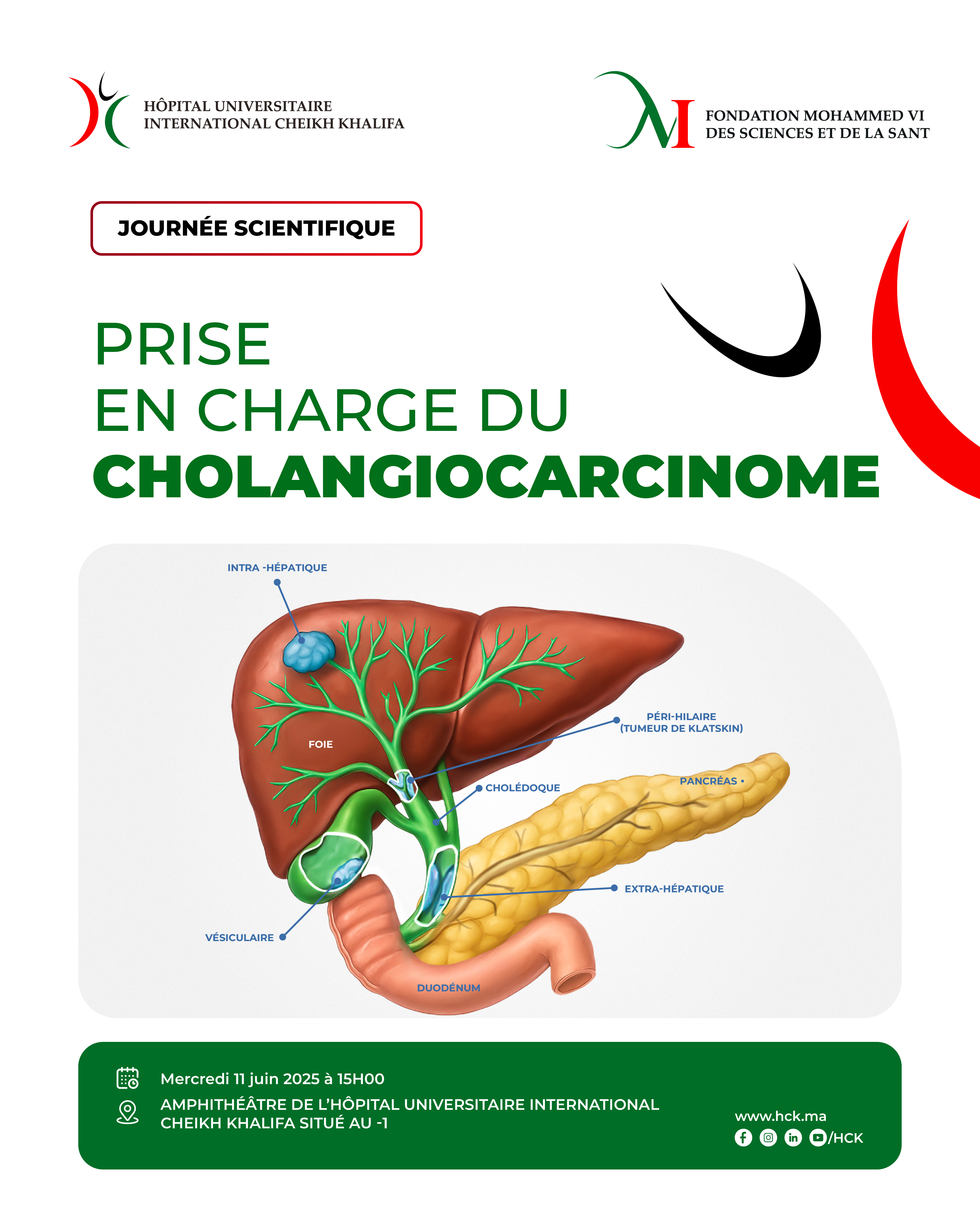JOURNÉE SCIENTIFIQUE : PRISE EN CHARGE DU CHOLANGIOCARCINOME JOURNÉE SCIENTIFIQUE : PRISE EN CHARGE DU CHOLANGIOCARCINOME
